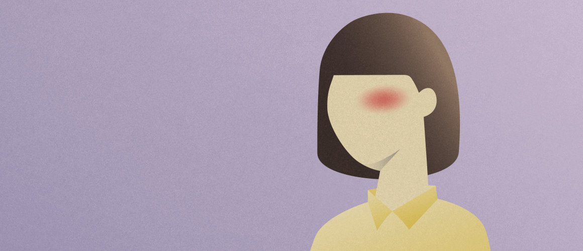 A woman with short hair and a red marking on her face that symbolizes a cluster headache.